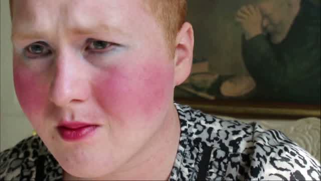 CopperCab Syndrome