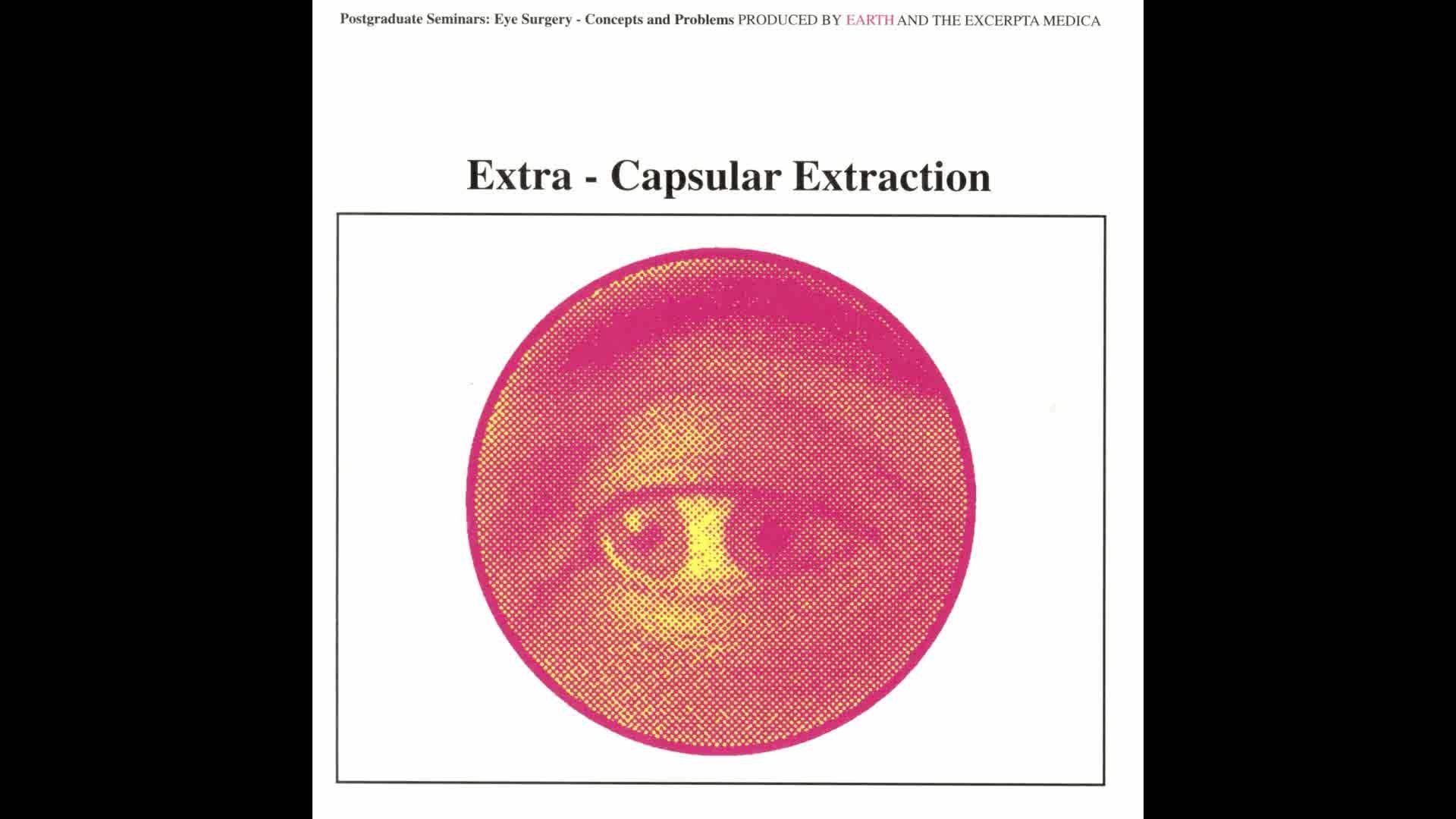 Earth - Extra-Capsular Extraction (Full EP)