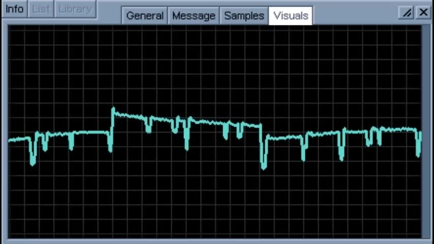 Surkov Classic Remixes (EP of fan remixes)