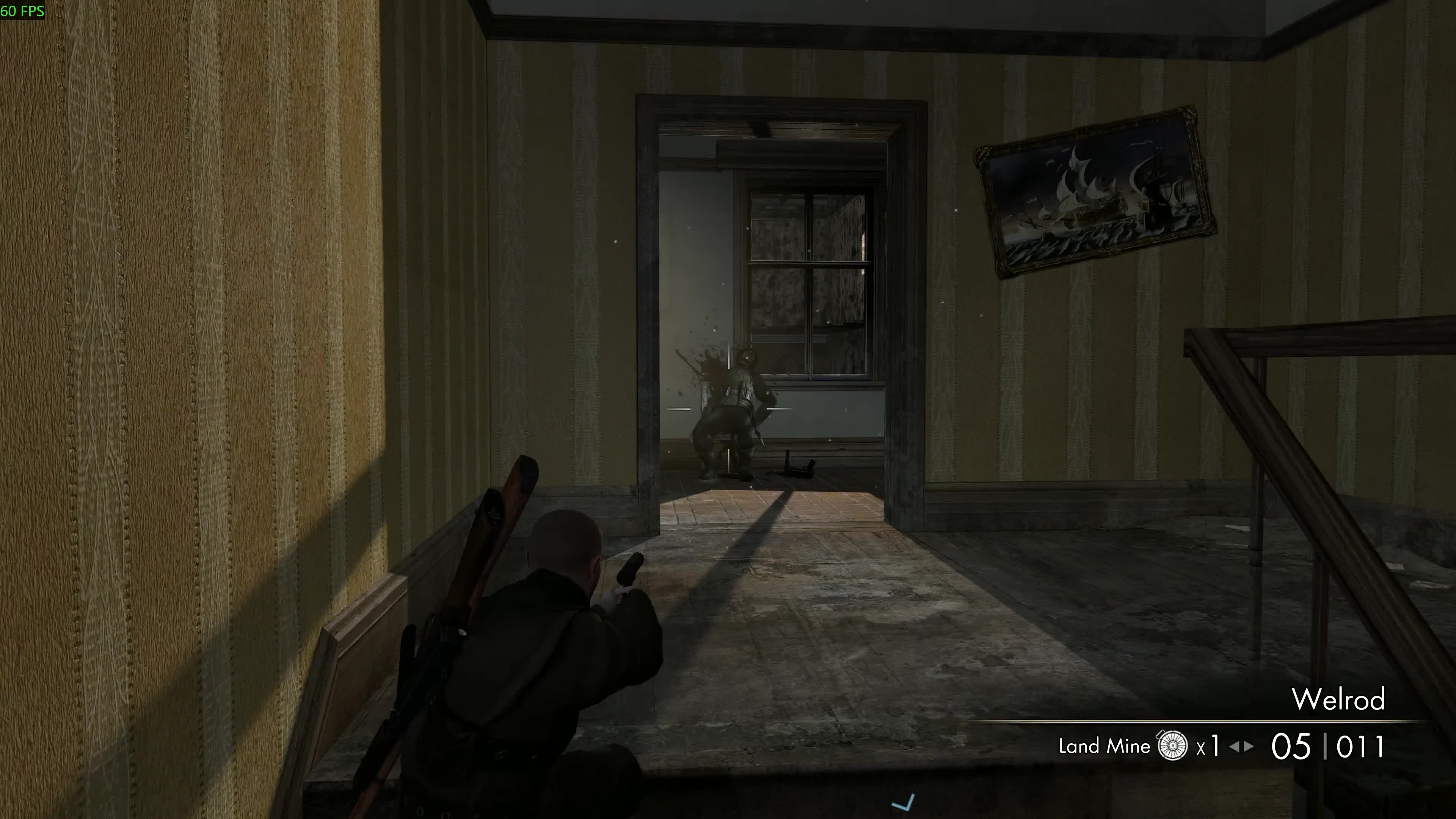 Where'd You Shoot Him?