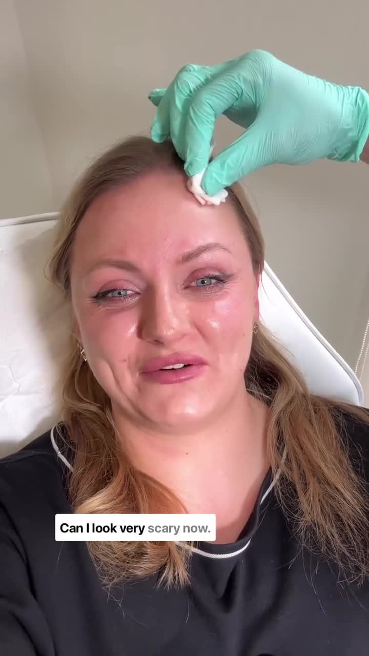 Wrinkle Treatment in Windsor – Natural Results at Bare Brilliance